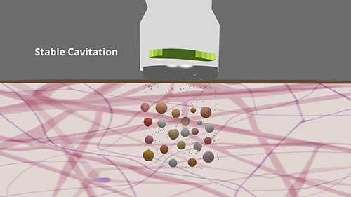 超声的原理与临床应用