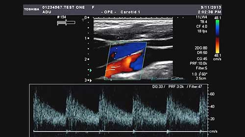 功能性超声的原理