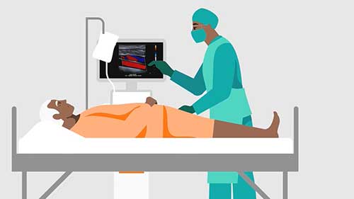 超声的工作原理