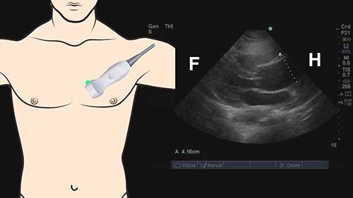 超声波的物理学知识