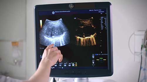 三种医用超声诊断仪