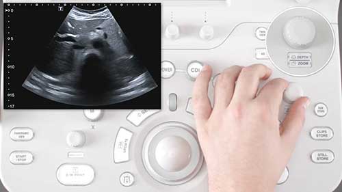 超声诊断仪的功能和操作