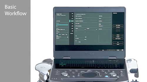 ME8型超声诊断仪