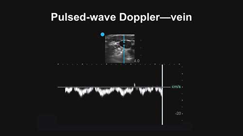 多种超声模式的使用