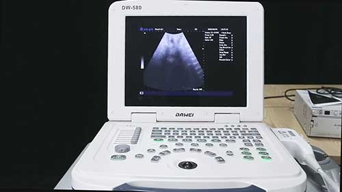 调试超声诊断仪的参数