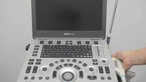 超声诊断仪的自检功能