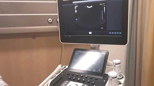 超声诊断仪的维护01