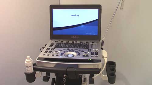 更换超声诊断仪的电池