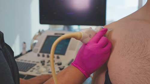 肌肉骨骼超声诊断