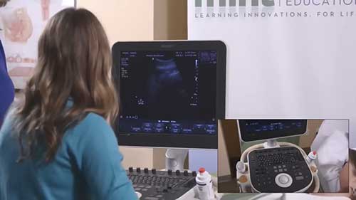 超声诊断仪的操作