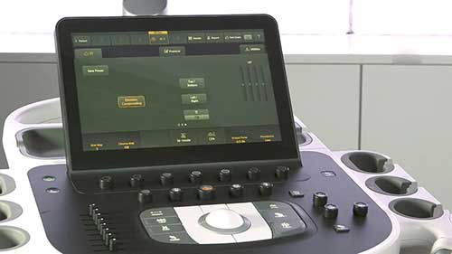 飞利浦EPIQ超声系统1