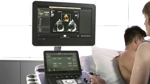 飞利浦EPIQ超声系统2