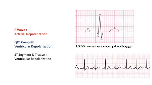 心电图机的历史和原理