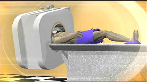 CT的诞生与影响