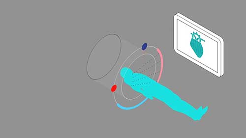 CT扫描及其原理