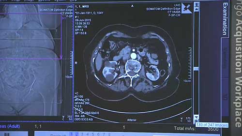快速了解CT检查