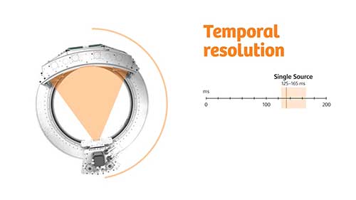 德国西门子双源CT