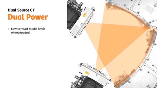 双源CT的特点