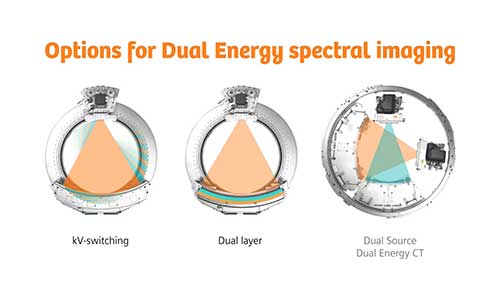 双源CT的双能量成像模式
