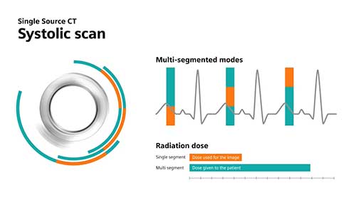 双源CT在心脏成像的应用