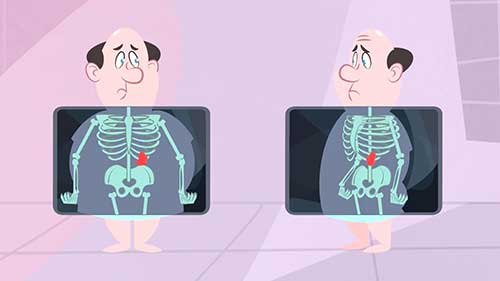 X线如何穿透皮肤