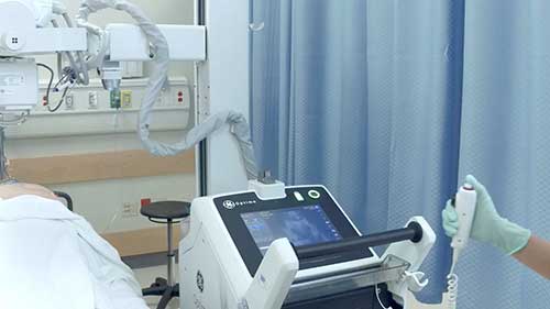 移动数字化X线机