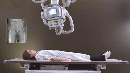 数字化摄影X射线机