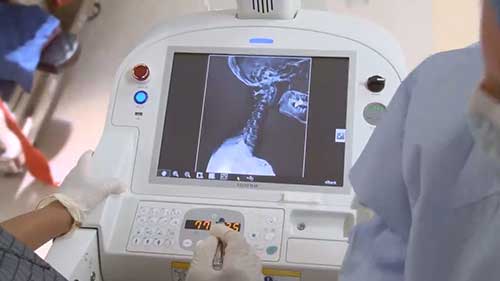 富士的数字化X线成像系统