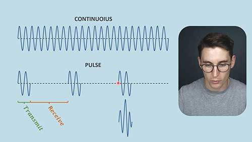 超声脉冲回波成像
