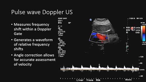 多普勒成像模式