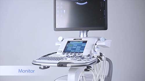 腹部超声扫描技术