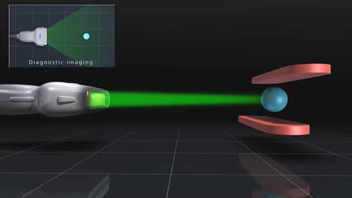 超声诊断系统的技术