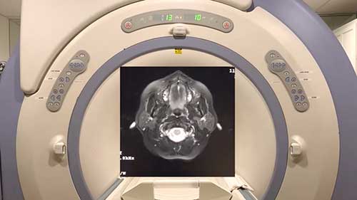 磁共振扫描的声音