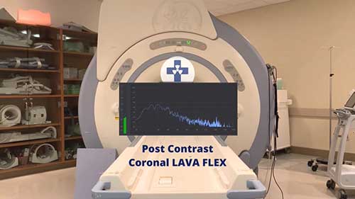 MRI扫描室里的声音
