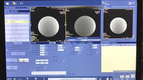 磁共振弥散加权成像