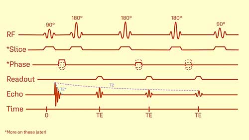 磁共振和自旋回声序列