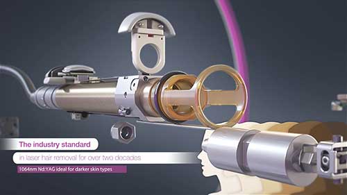 赛诺龙激光治疗仪