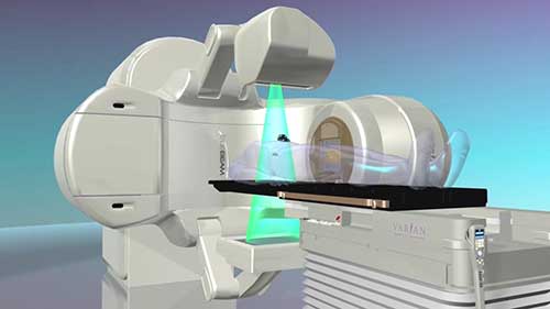 医用直线加速器