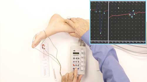 快速了解肌电图机