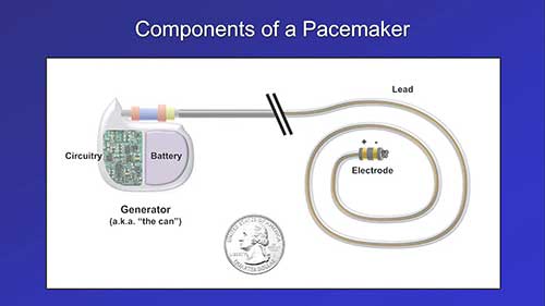 起搏器的类型与构成