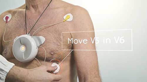 12导联动态心电监护仪