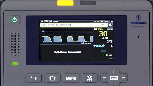 呼吸监测仪的故障排除
