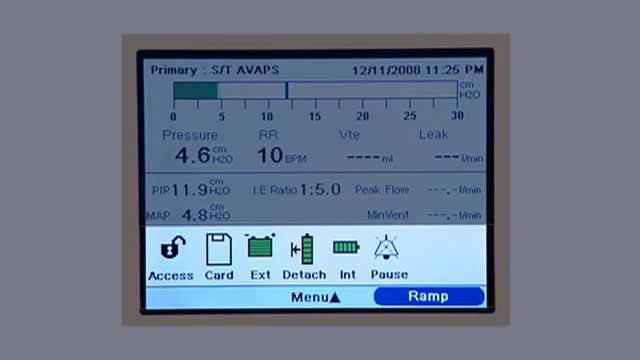 Trilogy 100无创呼吸机