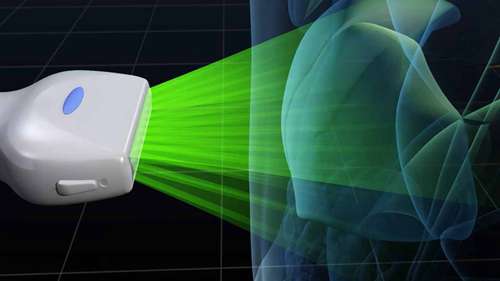 超声诊断系统的工作原理