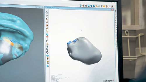 美国如何制造数百万助听器