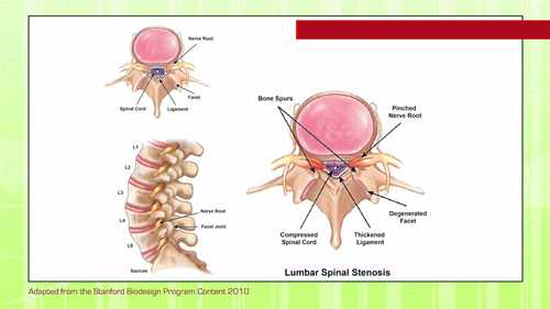 医疗器械 3.2 概念筛选