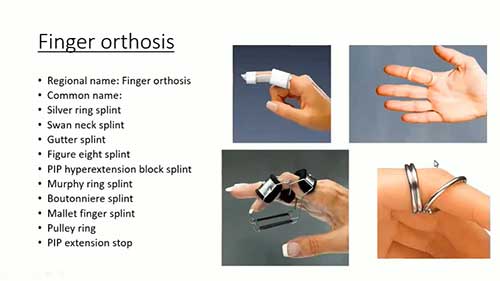 上肢矫形理论详解