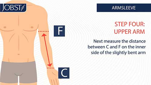 如何量身定制上肢矫形器