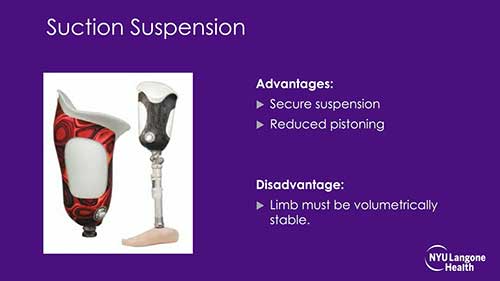 下肢矫形与修复