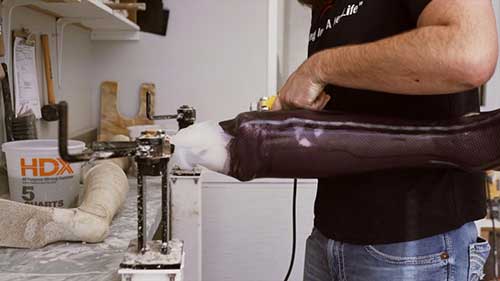 假肢与矫形器的制造